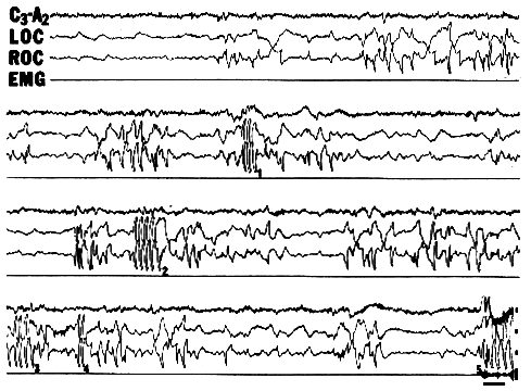 [Figure 2: DILD]